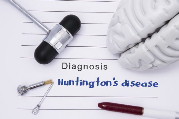 Huntington’s Disease
