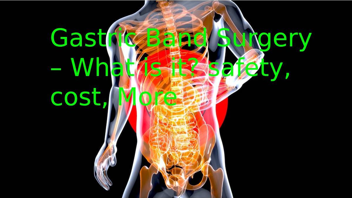 Gastric Band Surgery – What is it? safety, cost, More