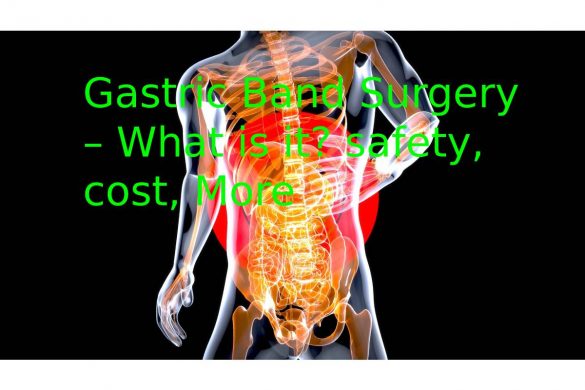 Gastric