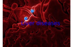 Liver diseases