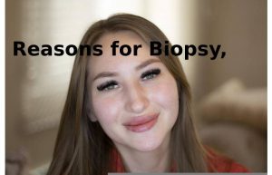 Reasons for Biopsy,