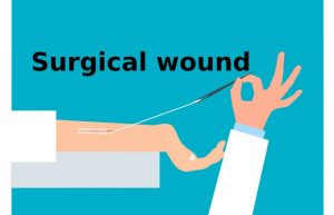 Surgical wound