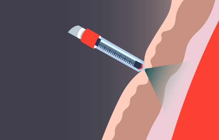 How is the vaccine administered needle free
